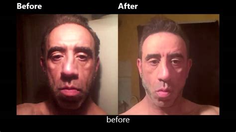 Face Exercises Before And After50year Old Man 10 26 15