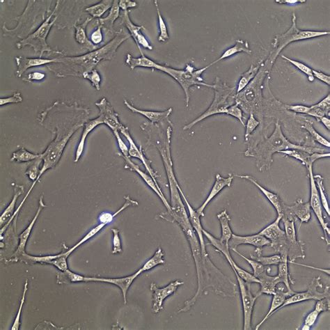 Human Mesenchymal Stem Cells Wharton´s Jelly Cellsystems