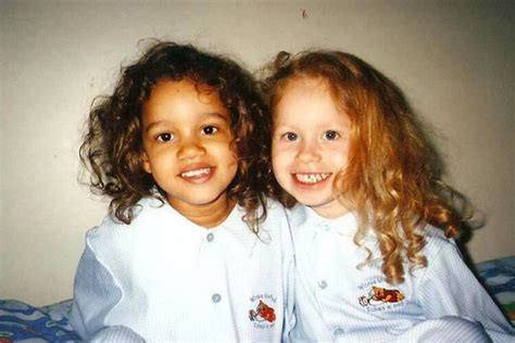 These Twin Sisters Were Born Different Colors Today Theyre Unrecognizable Biracial Twins