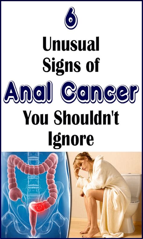 6 Unusual Signs Of Anal Cancer You Shouldnt Ignore Rharveycliniccare
