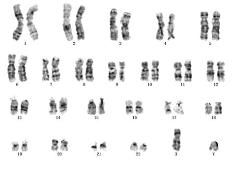In The Human Karyotype Above What Are The Chromosomes In Each Numbered