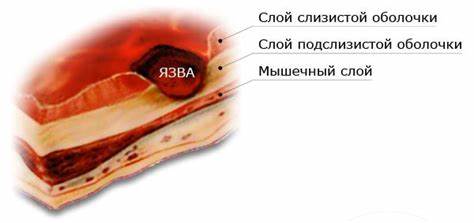 Язва и эрозия желудка диета Язва желудка у животных Язва желудка у животных Язва и эрозия желудка диета