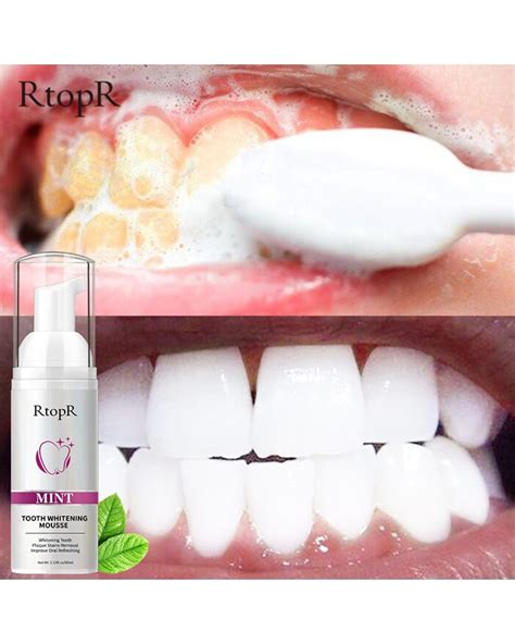 Rtopr Teeth Cleansing Whitening Mousse Removes Stains Teeth Whitening