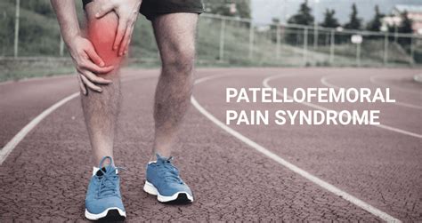 Are You At Risk For Patellofemoral Pain