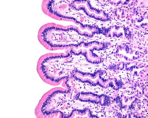 Stomach Surface Epithelium Photograph By Jose Calvo Science Photo Library Pixels