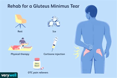Gluteus Minimus Anatomy Function And Treatment
