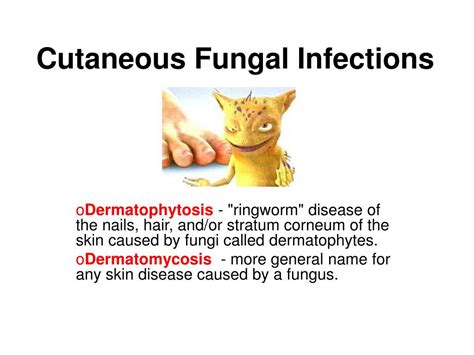 Ppt Cutaneous Fungal Infections Powerpoint Presentation Free