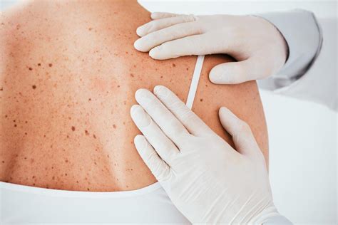 Skin Health And Prevention 20 Ce For Nurses Medline