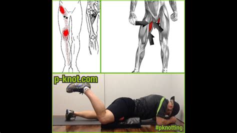 Groin Pain P Knotting Adductor Longusadductor Brevis Is A Great Way