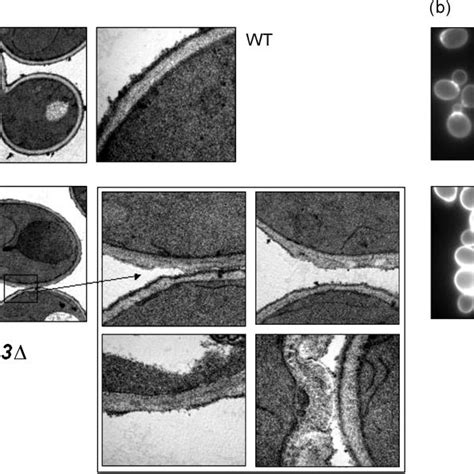 Msn india offers latest national and world news, with the best of cricket, bollywood, business, lifestyle and more. Polysaccharide hydrolase activities and fibre wall autolysis. a Release... | Download Scientific ...
