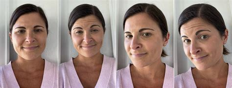 My First Botox Experience At 30