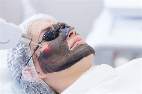 Carbon Laser Facial Lux Laser And Beauty Clinic