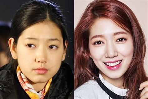 Did Park Shin Hye Get Plastic Surgery And Nose Job