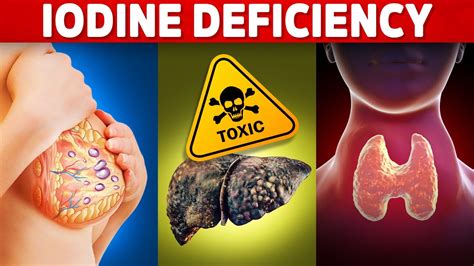 The 5 Signs And Symptoms Of An Iodine Deficiency Youve Never Heard