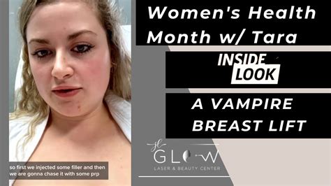 Women S Health Month With Tara A Vampire Breast Lift YouTube