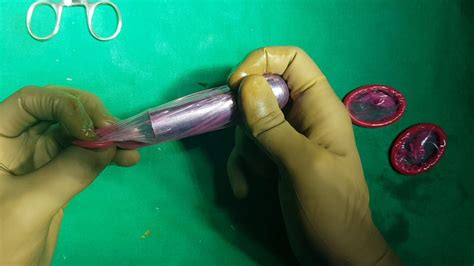 Vaginal Reconstruction With Interceed Dr Jay Mehta Youtube