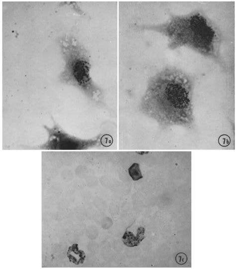 A Cultivated Peritoneal Macrophages Labeled In Vivo Giemsa X 1000