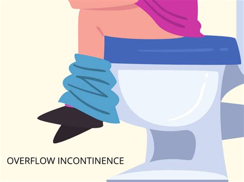 Your Ultimate Guide To Urinary Incontinence In Singapore Netcom Direct