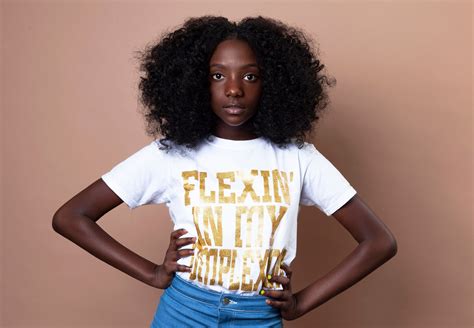Flexin In Her Complexion Bullied Girl Inspires Inquirer Lifestyle
