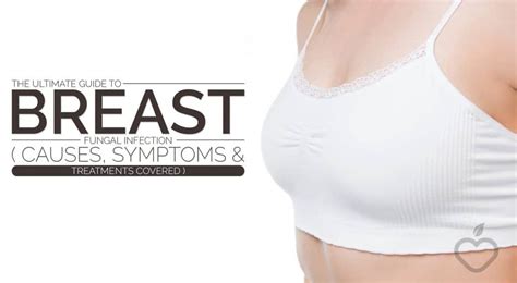 The Ultimate Guide To Breast Fungal Infection Causessymptoms And