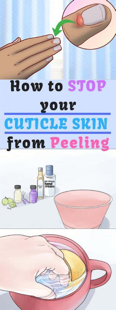 But you could be using the wrong products to moisturize. Dry, peeling cuticles can be quite painful and look ...
