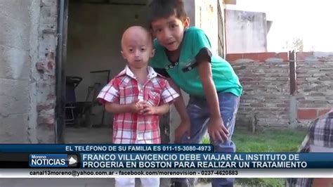 Franco Villavicencio Tienen Progeria Vejez Prematura Y Necesita Ayuda