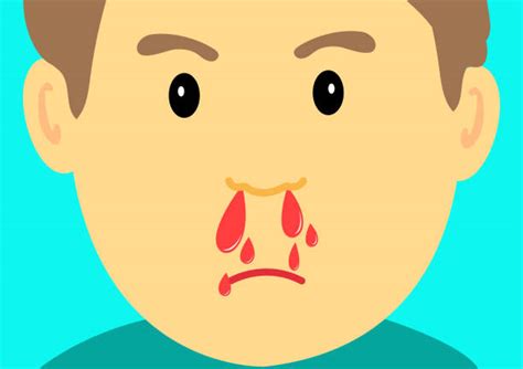 Bloody Nose Illustrations Royalty Free Vector Graphics And Clip Art Istock
