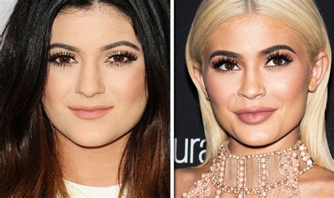 Kylie Jenner Plastic Surgery Before And After Life Life And Style