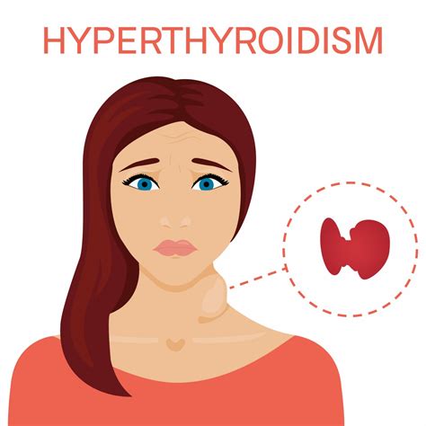 Mild Pulmonary Hypertension May Develop In Hyperthyroidism Patients