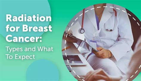 Radiation For Breast Cancer Types And What To Expect Mybcteam