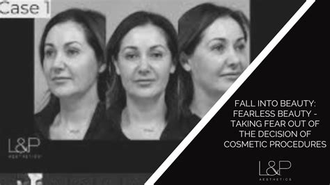 Fall Into Beauty Fearless Beauty Taking Fear Out Of The Decision Of Cosmetic Procedures Youtube