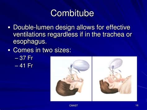 C191 W3tc Cmast Advanced Airway Techniques