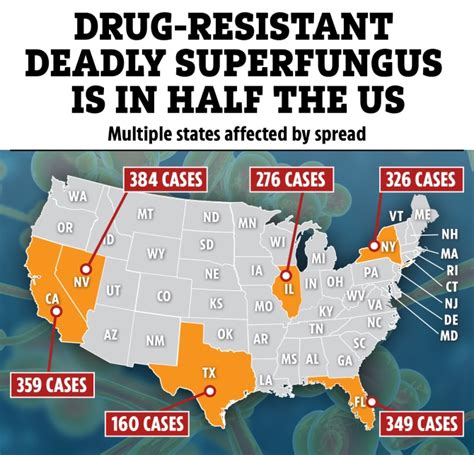 Drug Resistant Deadly Super Fungus Spreads To Half Of Us States See