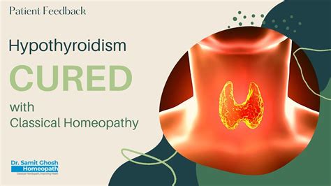Hypothyroidism Case Cured With Classical Homeopathy Patient Feedback