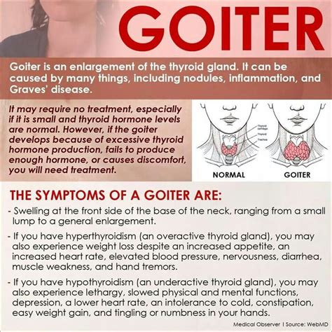 Goiter Symptoms Overcoming Graves Disease And Hashimotos Disease