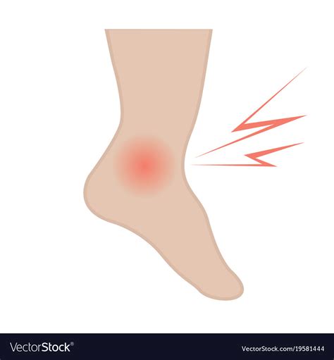 Swelling Feet And Ankles Royalty Free Vector Image