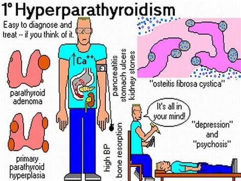 Hyperparathyroidism Nursing Symptoms Pathophysiology Nclex Hot Sex