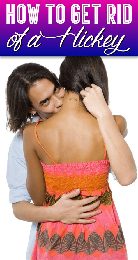 If you bring up your concerns about how long you're lasting and that you want to work on it with them, they're not going to think less of you. How to Get Rid of a Hickey Fast