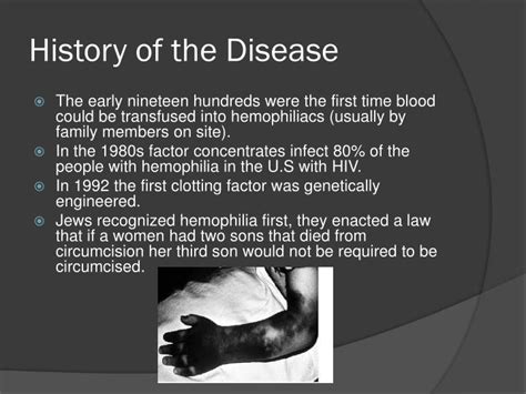 Hemophilia was recognized, though not named, in ancient times. PPT - Hemophilia PowerPoint Presentation - ID:2121812