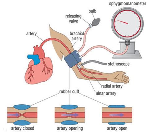 A Non Invasive Blood Pressure Measurement B Invasive Blood Pressure