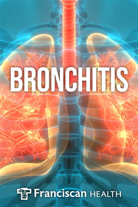 Bronchitis Franciscan Health