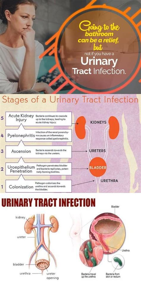 Urinary System System Infection Remedy Fast Signs And Symptoms With