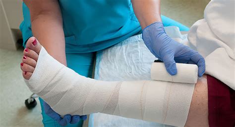 The Use Of Iodine In Wound Care Lalma