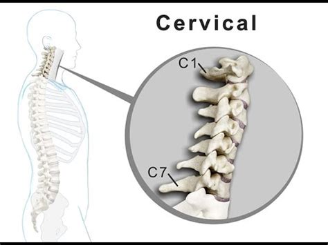 Collier souple de soutien avec housse de cervicalgie bénigne, torticolis, arthrose cervicale. VÉRTEBRA CERVICAL 1 O C1 Y C2 - SALUD GRATUITA DEFINITIVA ...