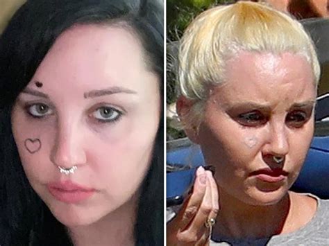 Amanda Bynes Appears To Be Removing Face Tattoo After Mental Health Center Check In