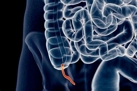 Appendix Pain Causes Treatment And When To See A Doctor