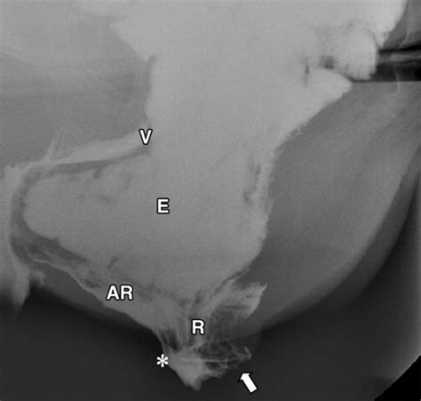 Functional Imaging Of The Pelvic Floor Radiology