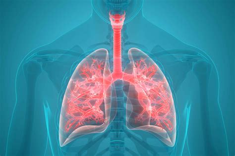 What Causes Lung Pain In The Back Roswell Park Comprehensive Cancer