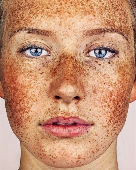 The Beauty Of Freckles By Brock Elbank Art Ctrl Del