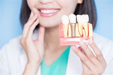How Long Do Dental Implants Last Ez Dental Clinic General Dentistry